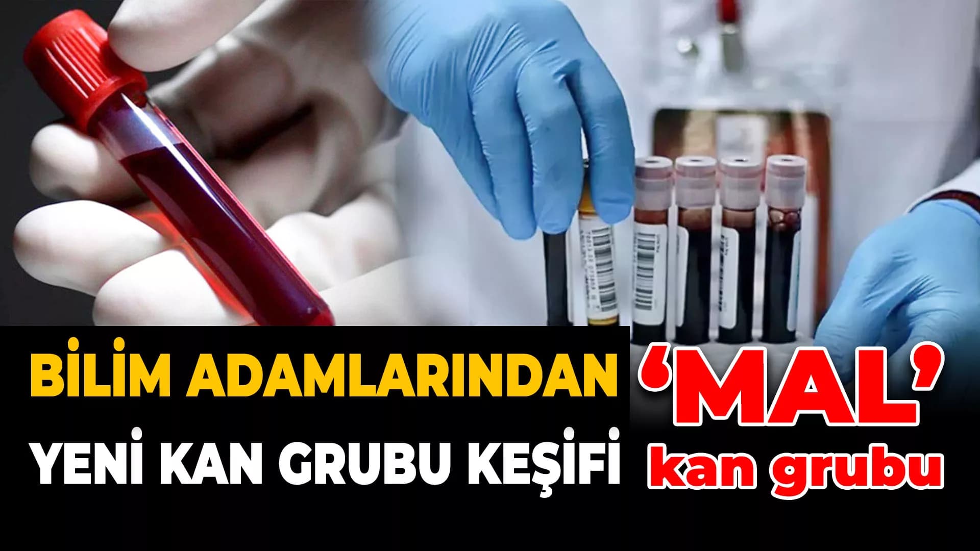 Yeni Keşfedilen Kan Grubu 'Mal', Tıp Dünyasında Heyecan Yarattı