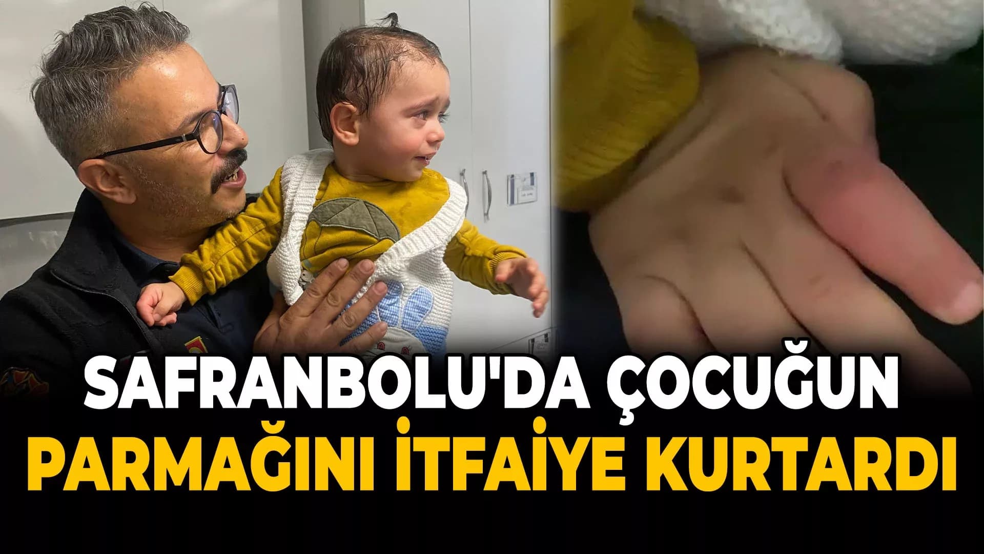 Minik Emir'in Parmağı Resepsiyon Ziline Sıkıştı