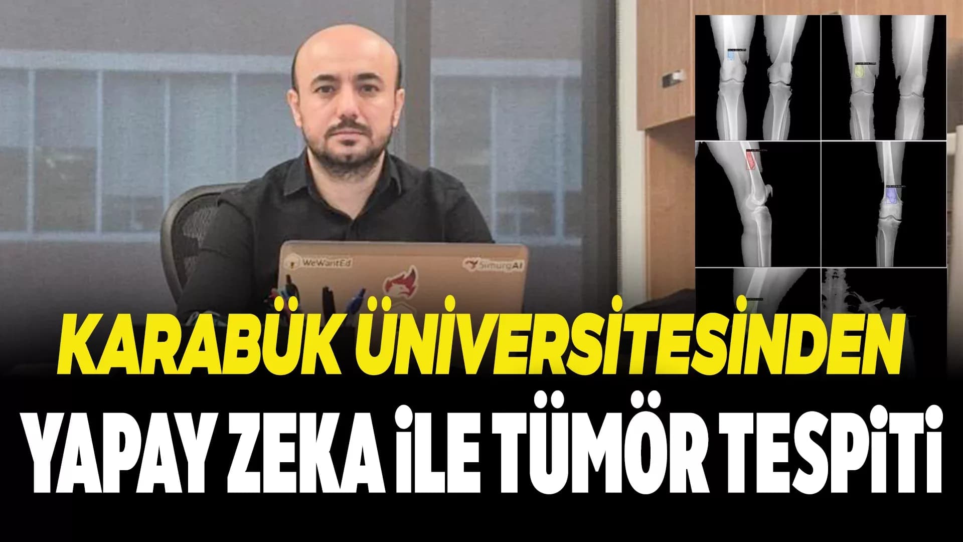 Karabük Üniversitesi'nden Yapay Zeka ile Tümör Tespiti