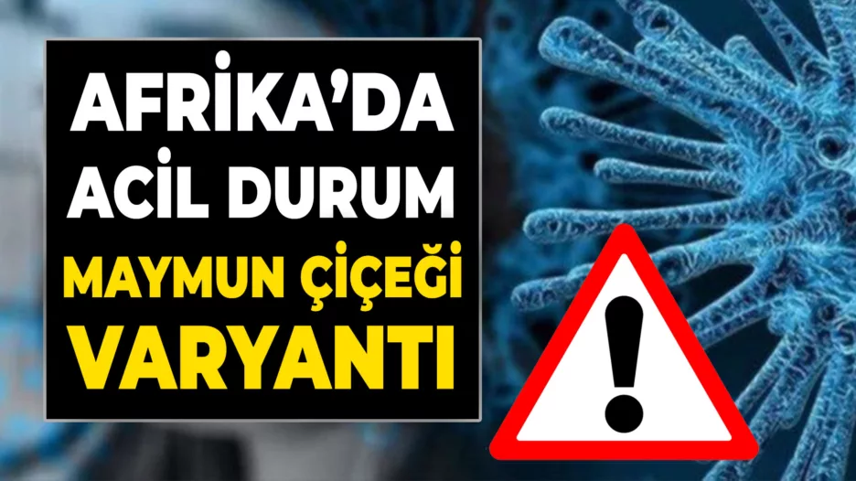 Afrika, Maymun Çiçeği Nedeniyle Acil Durum İlan Etmeye Hazırlanıyor