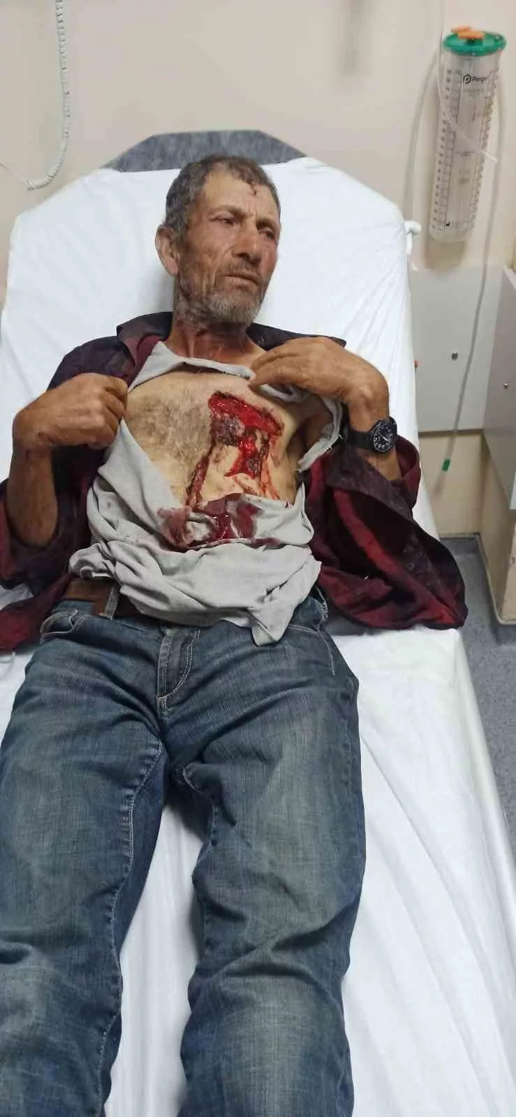 hayvanlarini otlatirken yaban domuzunun saldirisina ugradi ajdpVzZK jpg