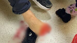 uyusturucu operasyonunda polise silahla ates acildi 2 polis yaralandi PVXyytNH