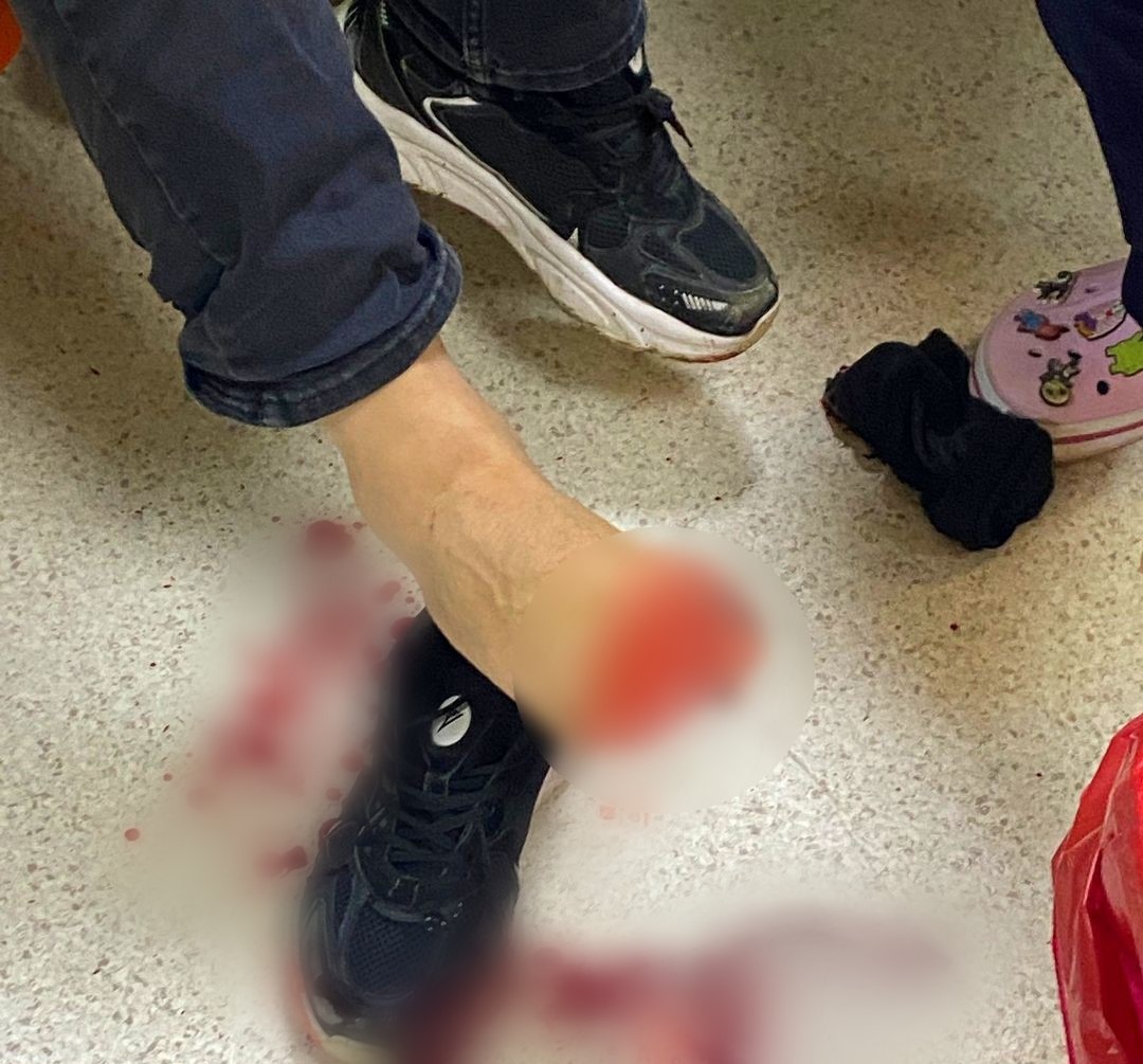 uyusturucu operasyonunda polise silahla ates acildi 2 polis yaralandi PVXyytNH