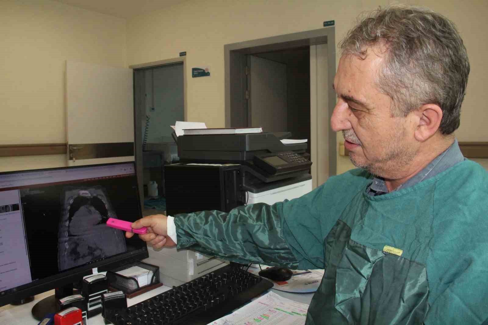 giresundan dunya tibbina yeni tani karadeniz sendromu qjzWmC6t