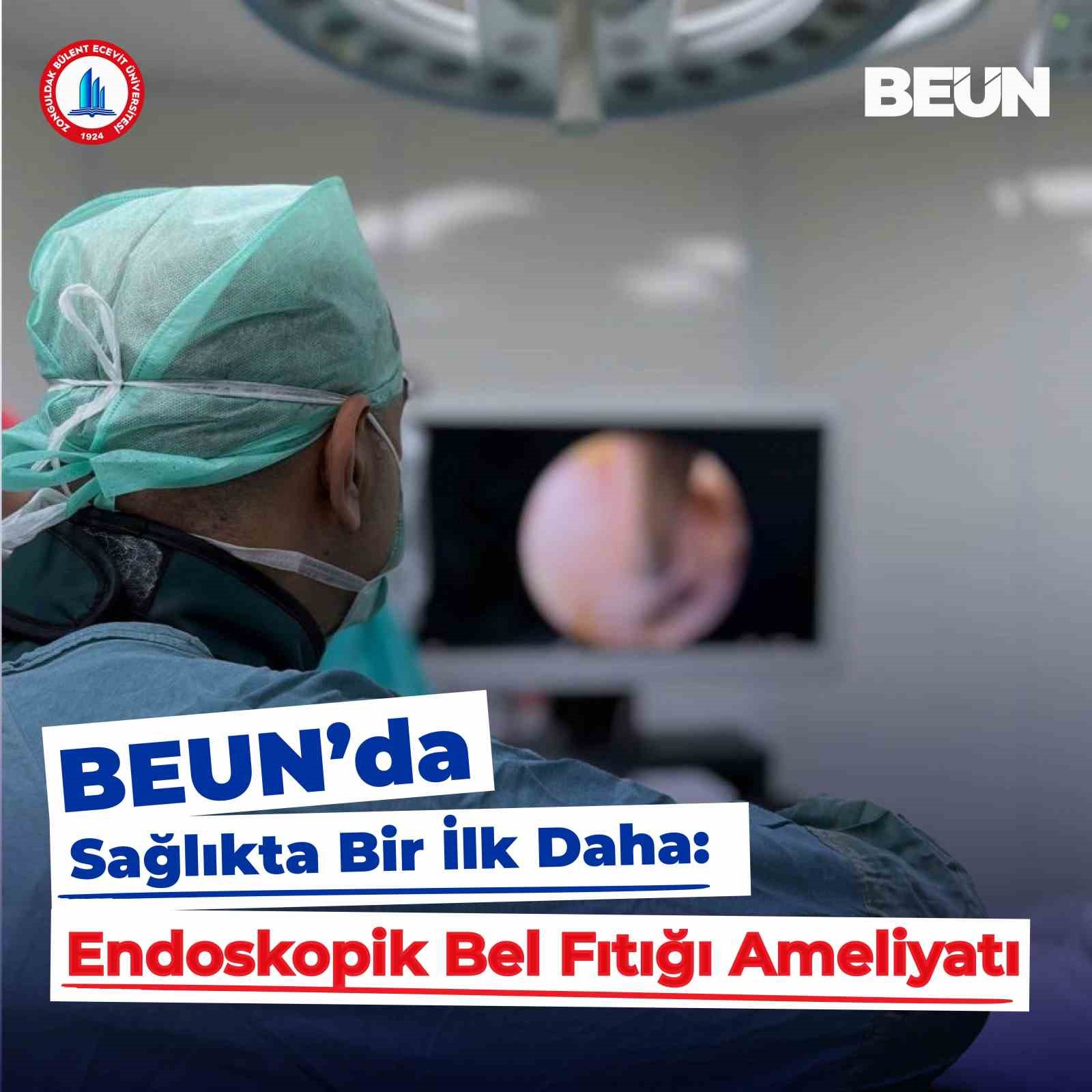 beun hastanesinde endoskopik bel fitigi ameliyati basariyla yapildi qH3f8pvy