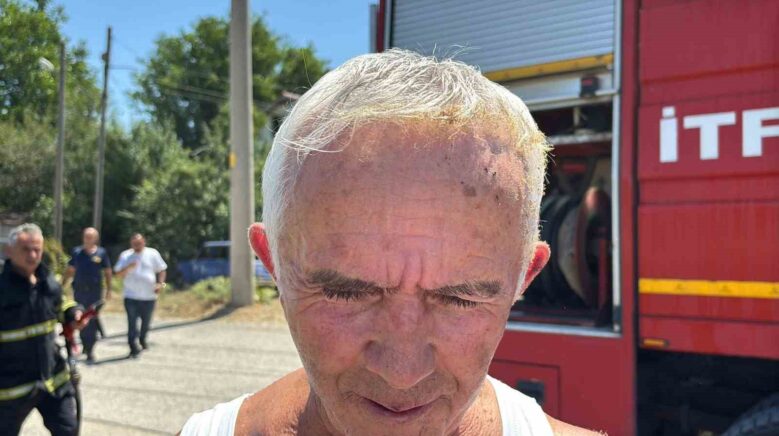 copleri yakmak isterken kendini de yakti S1z1O4Kh