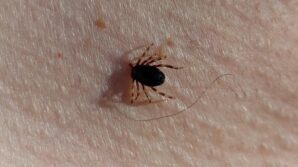 prof dr gurdal yilmaz bu yil 21 kkka vakasi geldi bu hastalardan ikisi hayatini TSLlYYLI