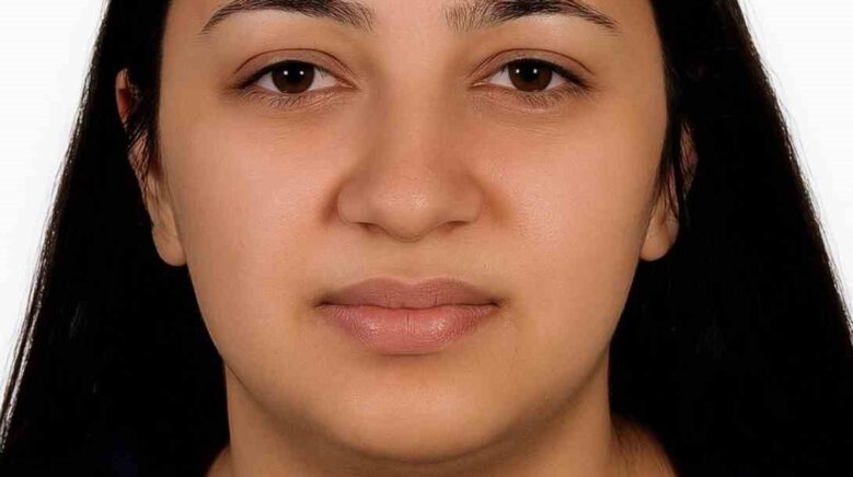 sobaya jel dokerken yanan genc kiz hayatini kaybetti wTJG3mF1